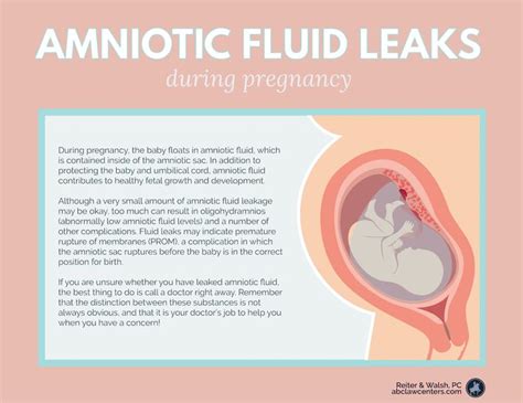 does leaking amniotic fluid smell|Leaking Amniotic Fluid: Signs, Causes, and。